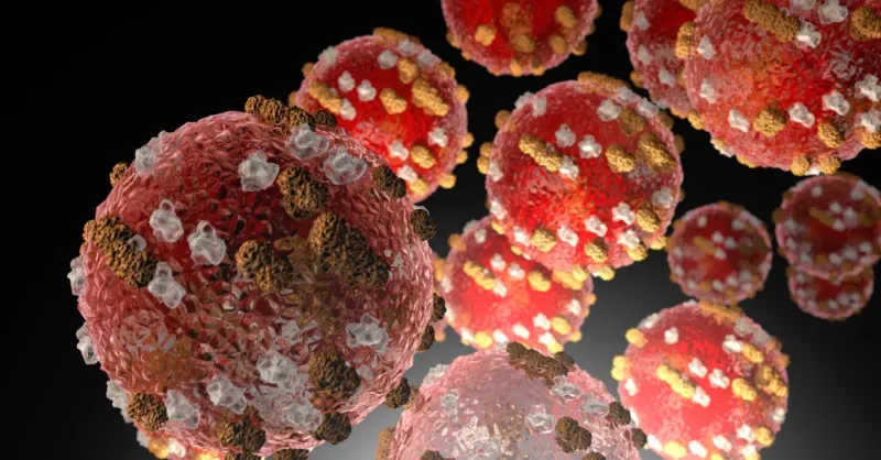 State on alert after measles detected in Anchorage