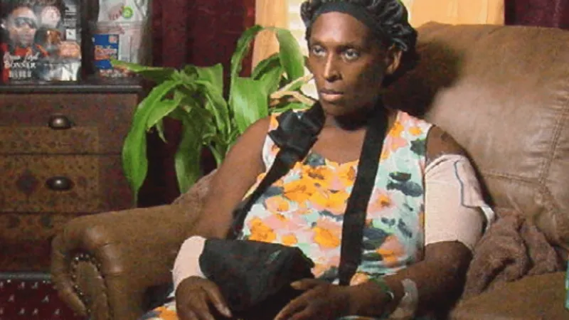 Baldwin County woman recovering after dog attack, owner charged