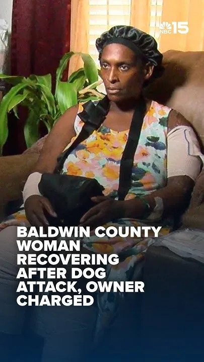 Baldwin County woman recovering after dog attack, owner charged - NBC 15 (Video)