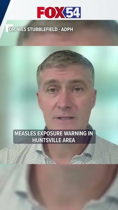 Measles case reported in Huntsville area after visits to local businesses (Video)