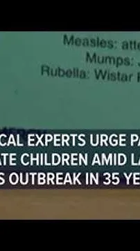 State medical experts urge parents to vaccinate children amid largest measles outbreak in 35 years (Video)
