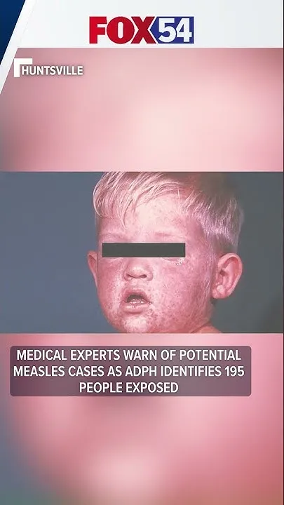 Medical experts warn of potential measles cases as ADPH identifies 195 people exposed (Video)