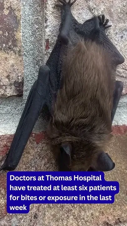 Thomas Hospital treats 6 patients with bat bites as concerns grow about rabies exposure (Video)