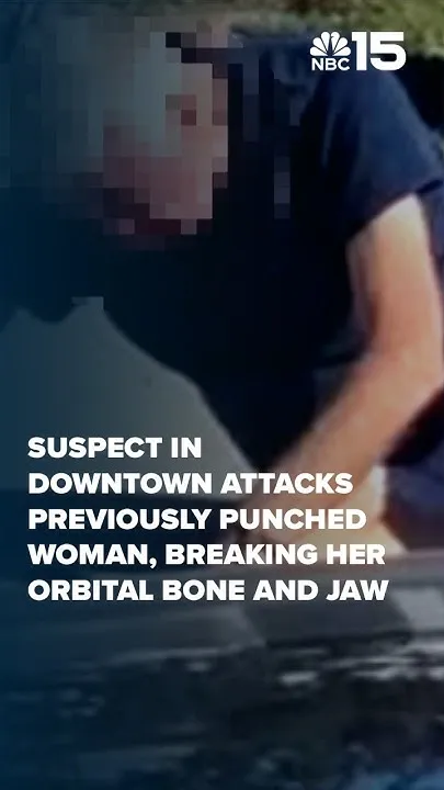 Suspect in downtown attacks previously punched woman, breaking her orbital bone and jaw - NBC 15 (Video)