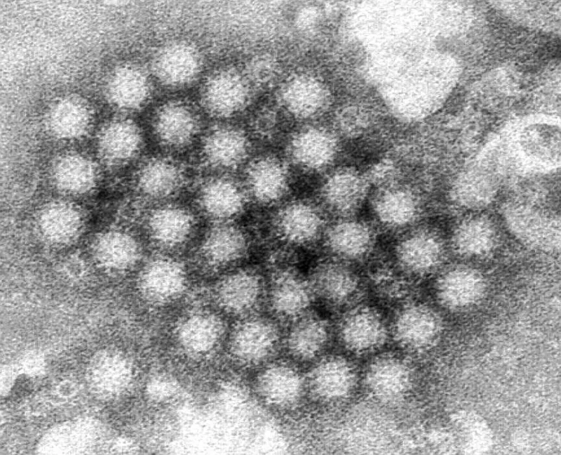 Searcy County School District closed Friday after two confirmed cases of norovirus