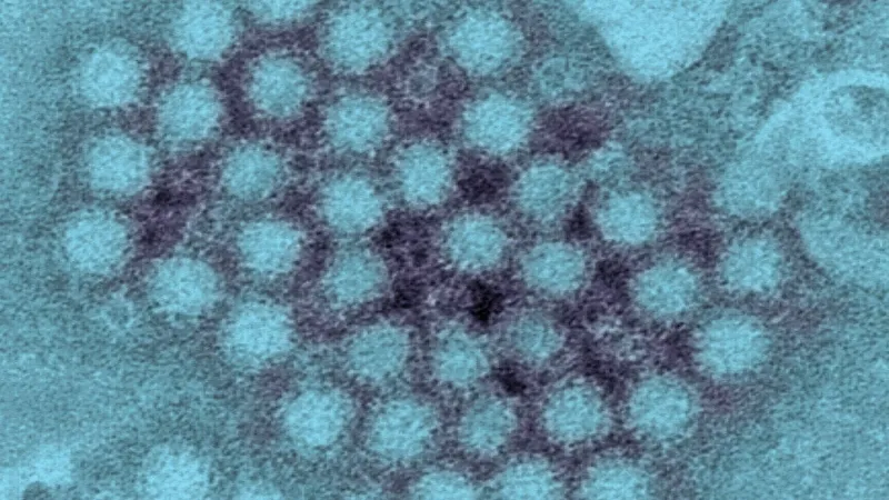 Searcy County schools closed Friday after two students diagnosed with norovirus