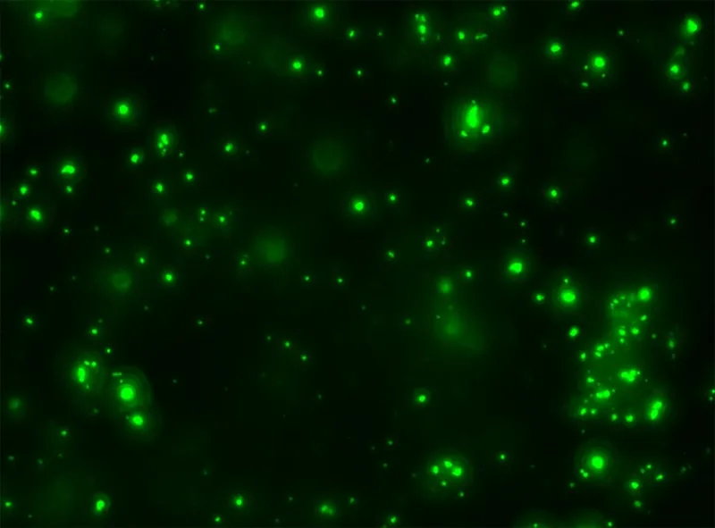 How waste build-up in the brain occurs in aging and neurodegeneration