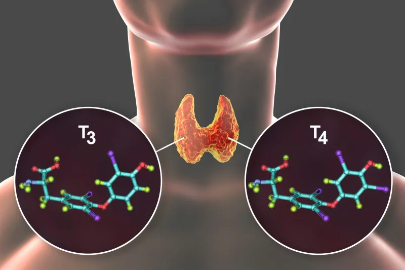 New Take on Treating Hypothyroidism