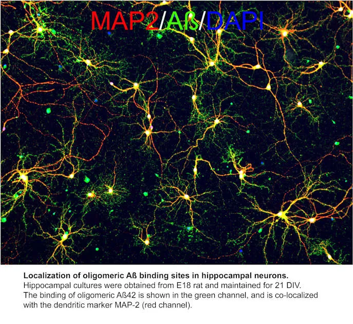 View of Alzheimer's disease peptide could inform new drugs