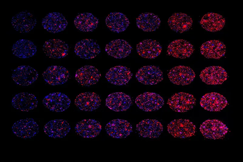 Exploring Precision Medicine for Pancreatic Cancer