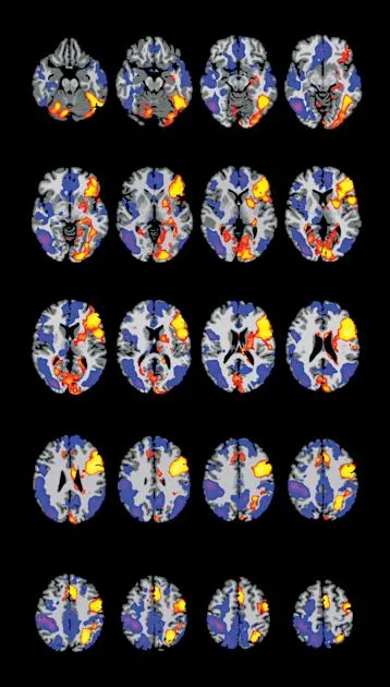 Why brain imaging doesn't always hold up - and how experts say to fix It
