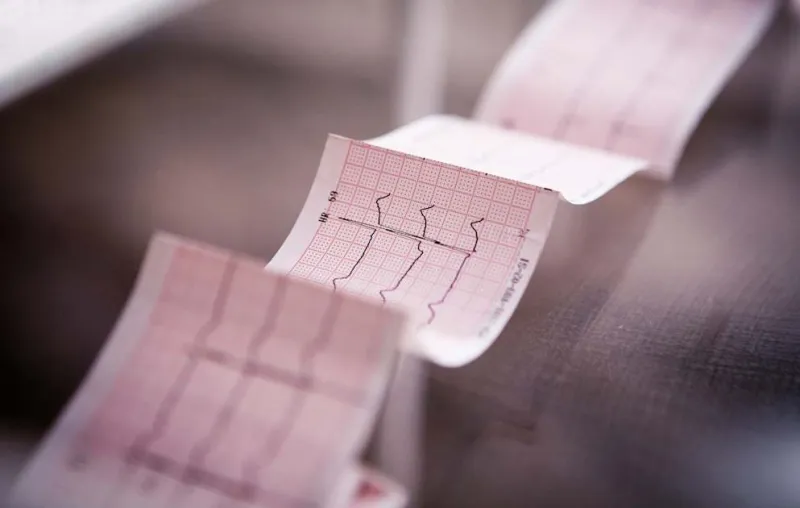 New AI tool detects widely underdiagnosed heart condition