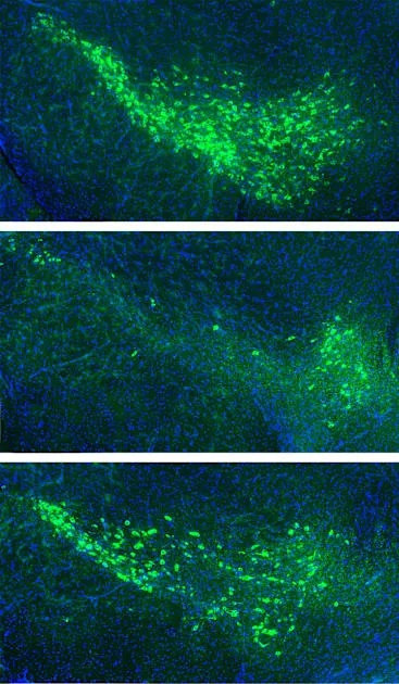 Managing misfolded proteins to prevent Parkinson's disease
