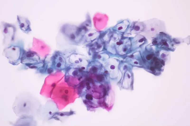 Cultivating HPV to improve vaccine development