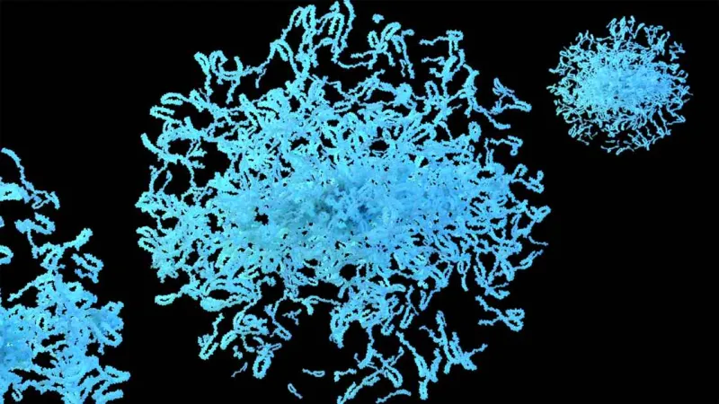 Preventing buildup of a toxic protein in Parkinson's disease