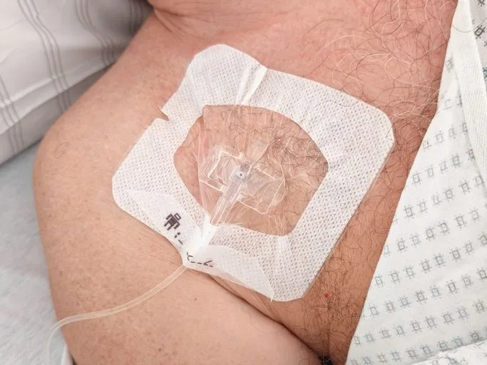 Men Can Get Breast Cancer Too. Here's What To Look For