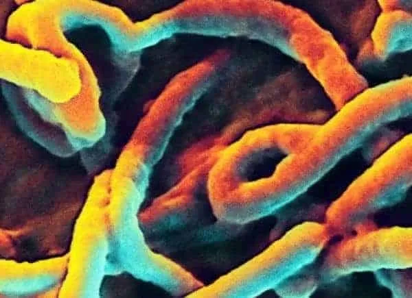 Ebola treatment capacity expands in DR Congo as WHO issues new guidelines