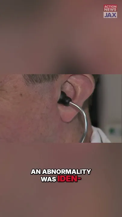 Pope Leo's Cancer: Lung Cancer Shock for Non-Smokers #shorts (Video)