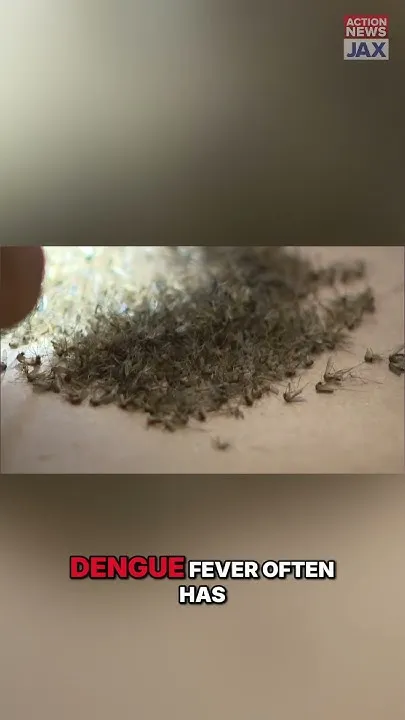 Dengue Fever Spreading: Florida's Mosquito Menace Alert #shorts (Video)
