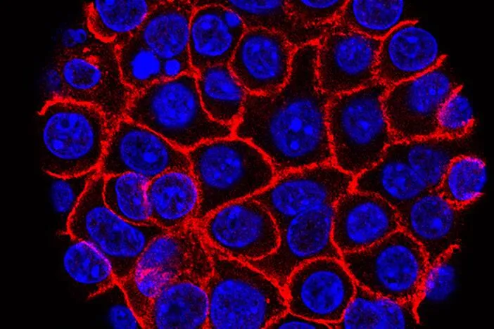 Experimental pill promises new hope for deadly pancreatic cancer