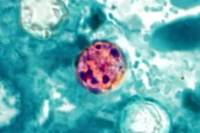 Georgia Today: Cyclosporiasis cases spread; Burke County Sheriff indicted; Childhood trauma study