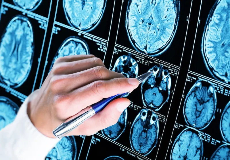 Study shows a blood test can help identify healthy people at high risk for Alzheimer's disease