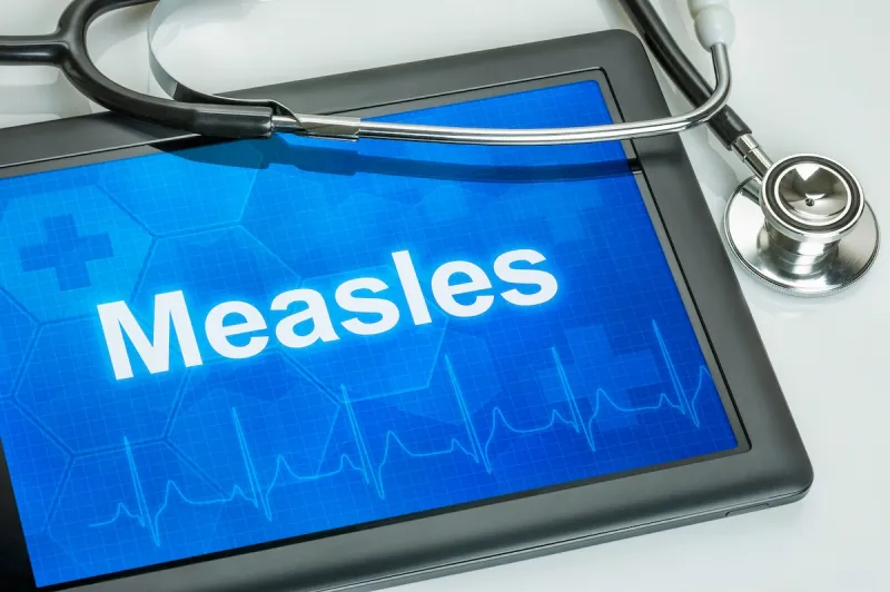 There are already more US measles cases this year than in all of 2025