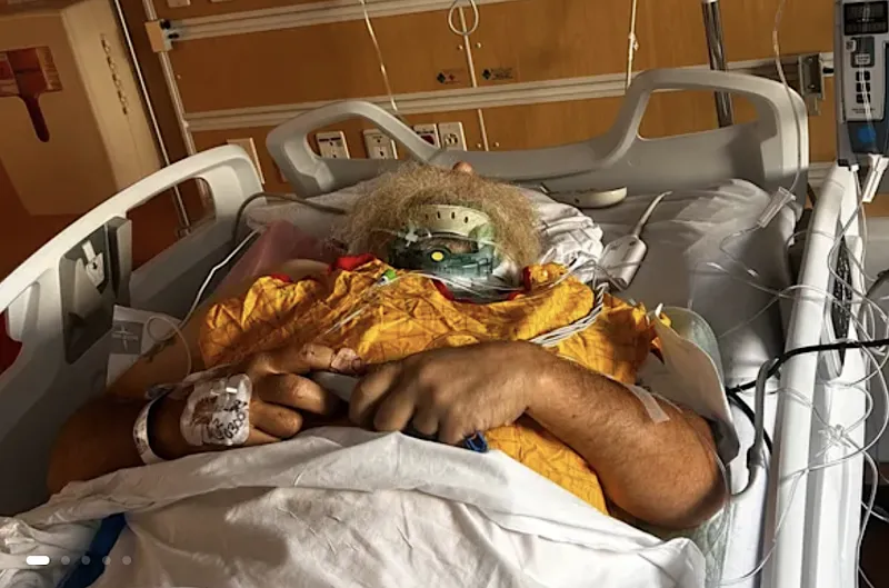 GDOT worker seriously injured by falling limb; fundraisers aim to help him and his family