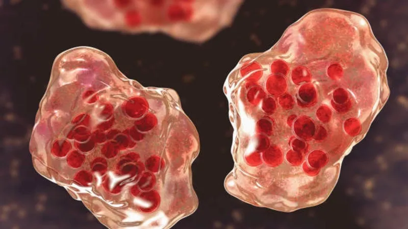 DPH warns of measles exposure at a Perry restaurant connected to Macon County case