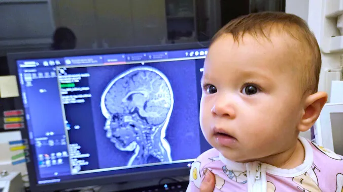 $3.3M grant funds UH microplastics, infant brain study