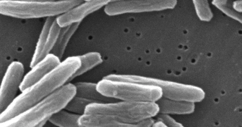 Illegal immigration contributes to an increase in disease