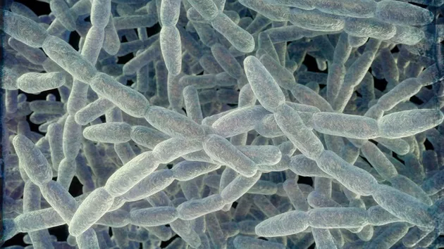 4th person dies from Legionnaires' disease in New York City: Health officials