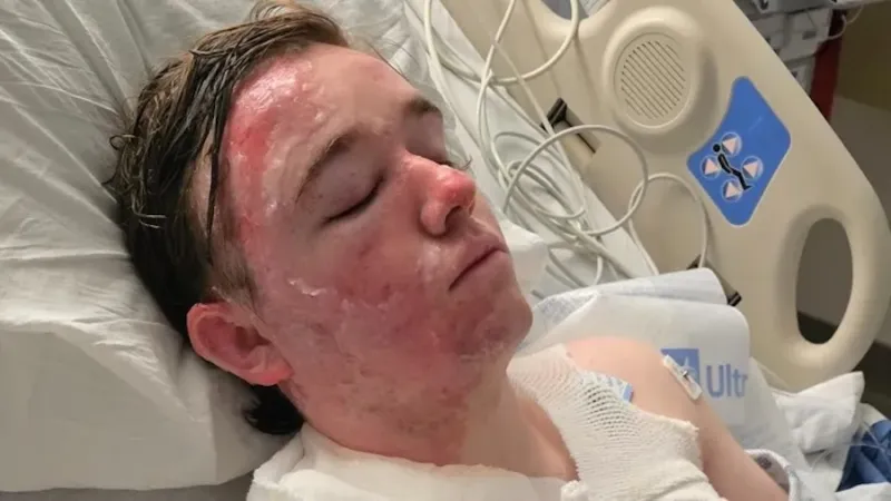 McDonald's shift manager burned over 22% of body in alleged hot oil attack