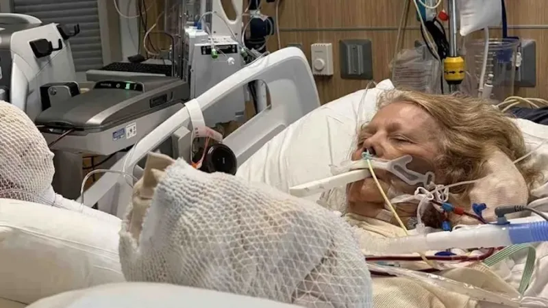 Woman suffers severe burns and heat stroke after falling asleep at community pool