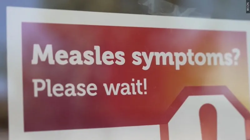 Measles case confirmed in Teton County, Idaho