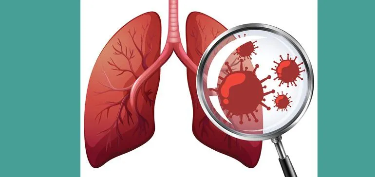 Mad about Science: Tuberculosis