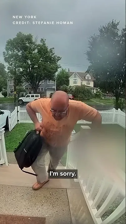 Man survives after being struck by lightning (Video)