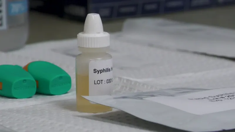 Southeastern Idaho Public Health offers free STD testing through September