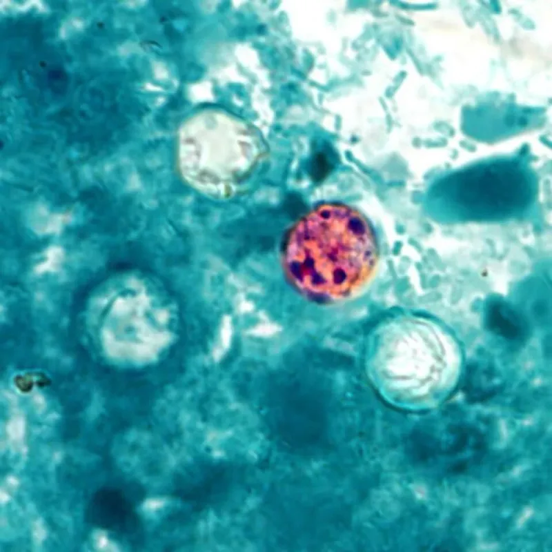 NO LOCAL CASES OF CYCLOSPORIASIS REPORTED