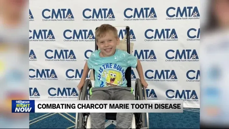 NWI Charcot Marie Tooth Disease Association to host walk for awareness on rare disease