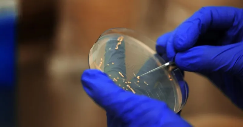 Could a flu vaccine derived from yeast replace annual jabs?