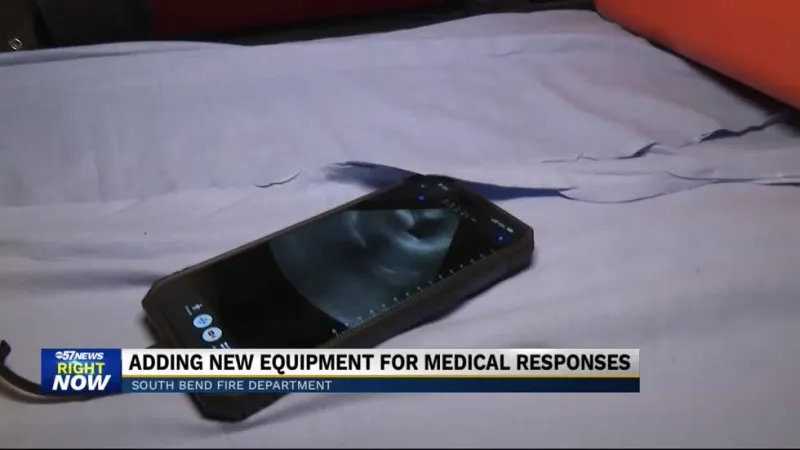SBFD soon implementing new ultrasound device when responding to medical emergencies
