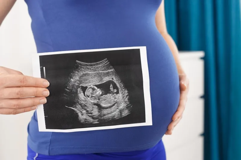 Expectant Moms Can Get Another Peek at Baby for Free