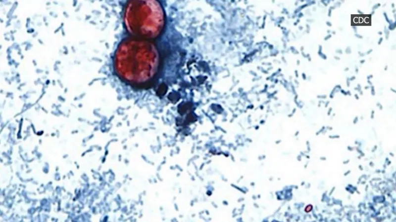 Berrien County Health Department receives grant to cover cyclosporiasis outbreak costs