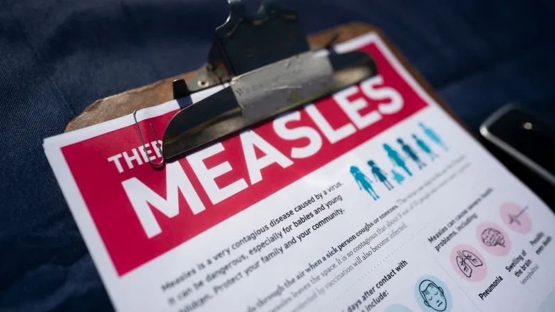 Measles possible at Fort Wayne Zoo