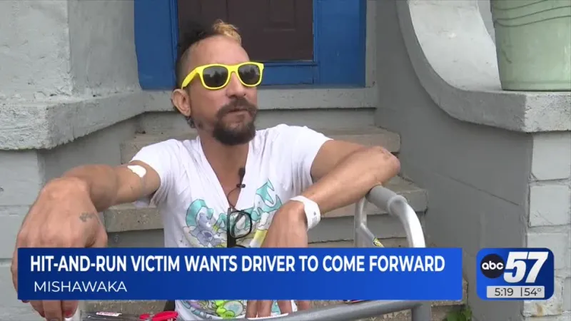 Victim of hit-and-run accident left unable to walk for months, suspect still out at large