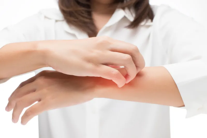 Highly Contagious Fungus Spreading Rapidly - What to Know