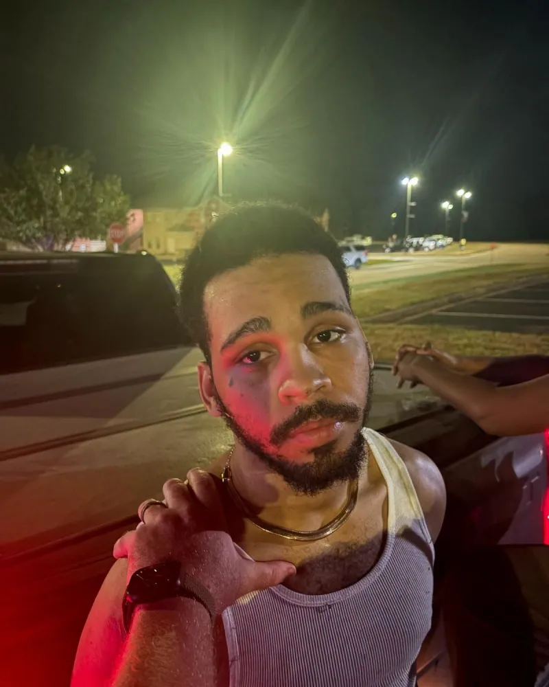 Escapee Tre'veon Jackson Is Back in Shreveport Where He Now Faces Federal Charges