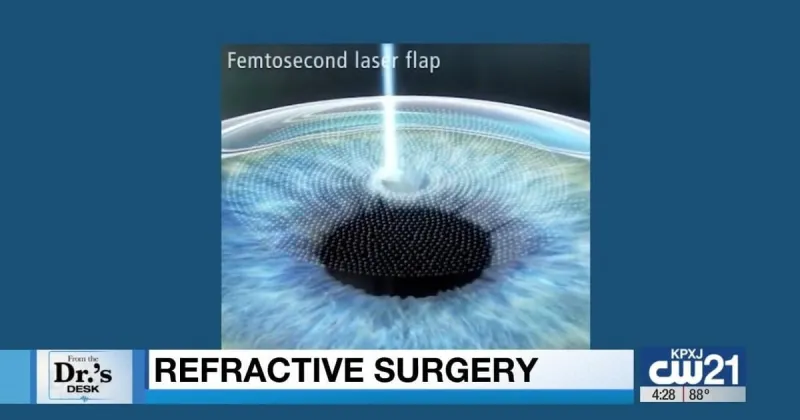 What to know about refractive surgery, how the technology has changed