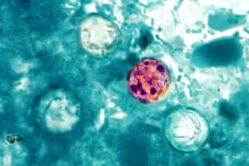 A parasite is running rampant in Michigan. Will it spread elsewhere?